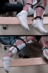 A 42-year-old man who was paralyzed after a wrestling injury was able to voluntarily move his legs thanks to neurostimulation, created by Professor Reggie Edgerton at UCLA.