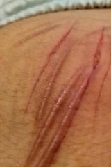 Mohammad Albederee has been cutting himself with a razor.