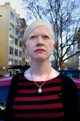 Dr Shari Parker, secretary of the Albinism Fellowship of Australia, objects to the depiction of albinos in film.