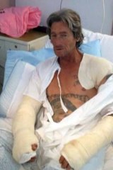 Recovering: The victim, identified by Channel Nine as Robbie Nelson, had a gaping wound under his arm.