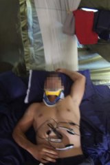 An asylum seeker in a neck brace after a suicide attempt.
