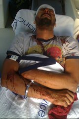 Racist attack ... Indian student Sukhraj Singh, 28, was in a coma for 15 days after being brutally bashed.