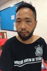 Ken Tsang was later photographed with bruising on his face and body.