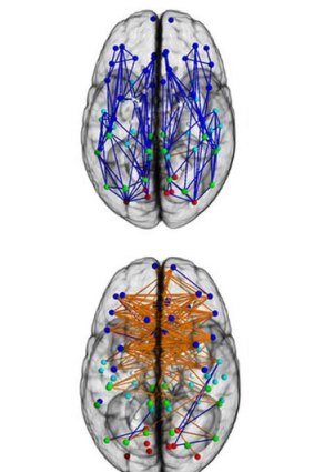 The female brain (orange) has stronger left to right links.