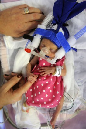 Special delivery: Premature baby Milica wraps a fragile hand around her mother's finger at the Royal Women's Hospital. 
