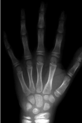On hand: X-rays will soon be part of online records.