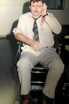 Detective Senior Constable Keith Bristow who had his ear bitten by Simon Gittany during an arrest in 1994.
