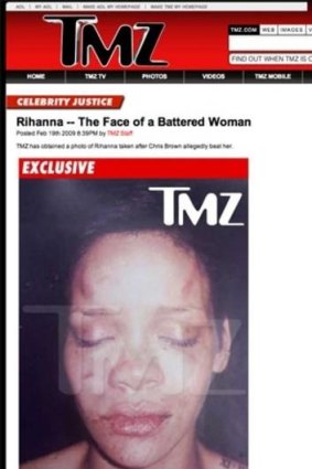 Low res only Rihanna is shown after she was beaten, according to TMZ.