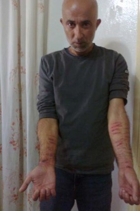 Ziad Awad shows cuts to his arms.