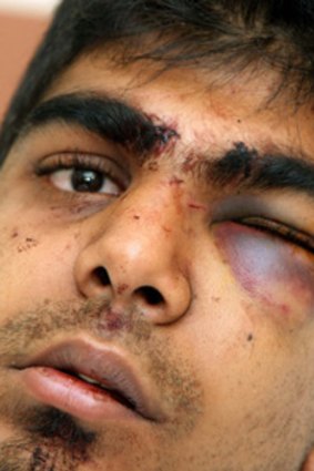 Munaver Khandwalla recovers in hospital after being bashed and robbed in Bentley.