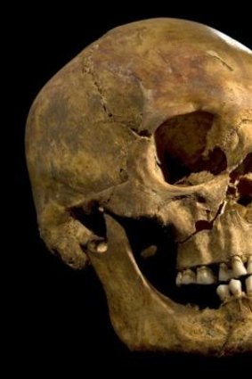 The skull of King Richard III found at the Grey Friars Church excavation site in Leicester.