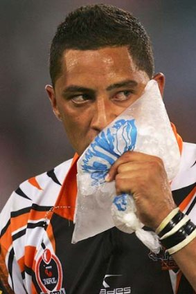 "The Tigers got the message that Benji should have come off to be properly assessed" ... NRL chief medical officer, Ron Muratore.