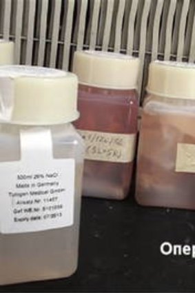 Bottles of human tissue labelled ''Made in Germany, Tutogen" that were were seized by Ukrainian authorities.      MykolaivSeizure1.jpg