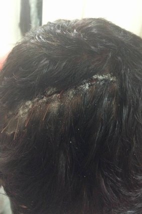 An Iranian asylum seeker at Nauru alleges he was slashed in the head with a large knife in an unprovoked attack by two locals. 