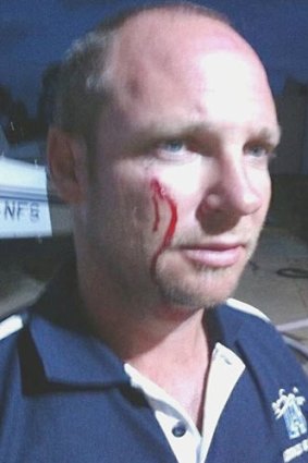 Pilot Josh Liddle was left covered in blood when a bat smashed into his cockpit.