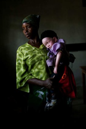A mother and her albino child in the documentary <i>In the Shadow of the Sun</i>.