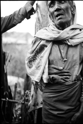 A Rohingya refugee nurses a badly broken arm in a Teknaf makeshift camp on the Myanmar Border. 