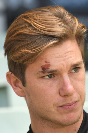 Worse for wear: Adam Zampa at the MCG on Thursday.