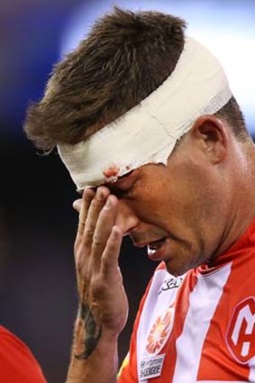 Harry Kewell was injured during the Melbourne derby.