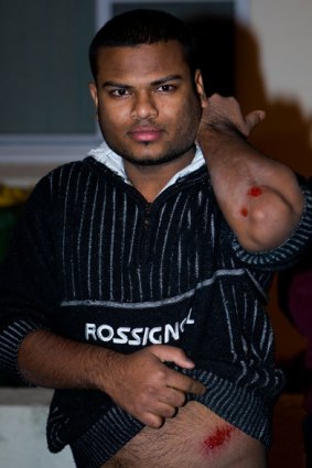 An Indian male displays his injuries after a group of males attacked him as tensions boiled over in Harris Park last night.