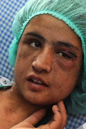Horrific ... Sahar Gul was beaten by her mother-in-law.
