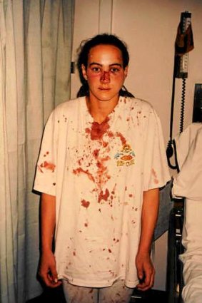 Long wait: almost 20 years after having her nose broken in an unlawful police raid, Corinna Horvath has won compensation from Victoria Police.