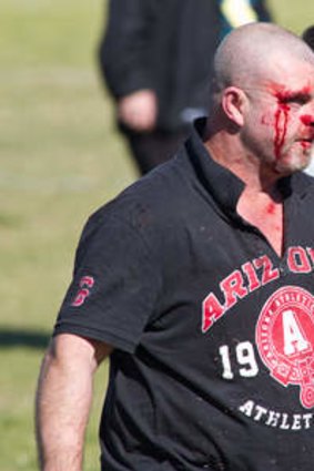 Stepping up: Scott Weekes suffered a bloody head after he was stomped on during the brawl at Turnbull Oval in North Richmond last Saturday.