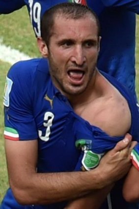 Italy's defender Giorgio Chiellini shows a bitemark on his shoulder.