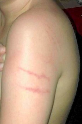 A young boy who was physically restrained while in care.