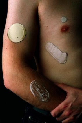 Nicotine patches became available under the Pharmaceutical Benefits Scheme last year.