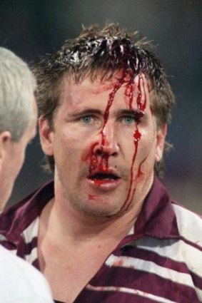 Queensland prop Gavin Allen spilled blood for the cause.