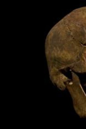 The skull of King Richard III.