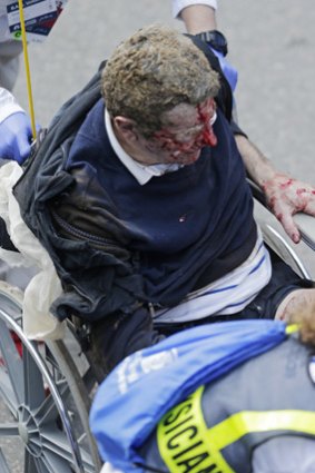 Medical workers aid an injured man at the finish line.