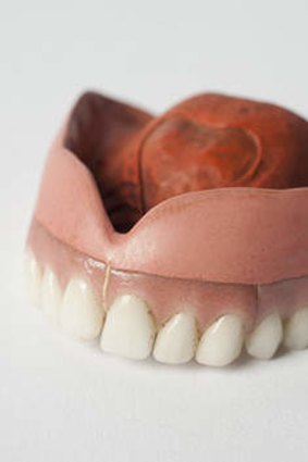 19th century chemist dentures.