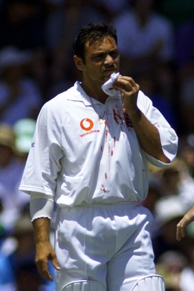Mark Ramprakash holds a cloth to his bleeding jaw after being struck by a delivery from Glenn McGrath at the WACA in 1998.