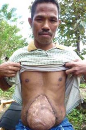 Adelino Madeira shows his scars.