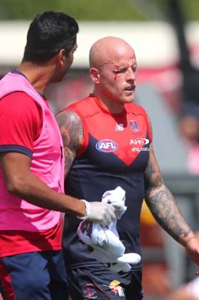 Nathan Jones leaves the fray with a sore shoulder and bloodied face after a collision with Jordan Lewis.