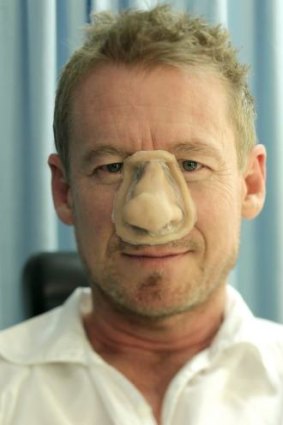 Step one: The nose prosthetic is placed on Richard Roxburgh's face.