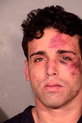 Joey Kadmiri's mug shot, taken shortly after his arrest, shows his face covered in bruises and abrasions.