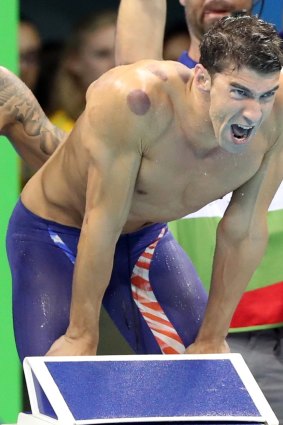 American star Michael Phelps was covered in cupping marks during the 4x100 metre freestyle relay in Rio.