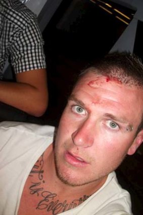 Accused: Shaun McNeil displays his bloodied head from a previous incident on social media.