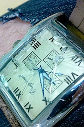 Mr Chatfield's smashed watch.