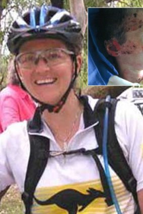 Kate Sanderson is returning to the region she was injured. Inset: Injuries after the fire.
