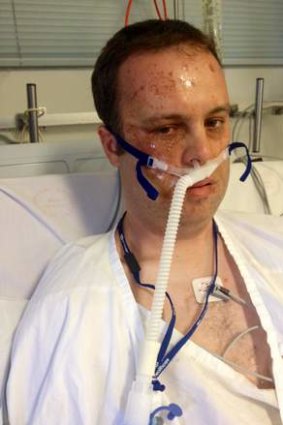 Clinton Maynard 2UE news content director after accident with chlorine chemical he was adding to his swimming pool. Photo: Supplied