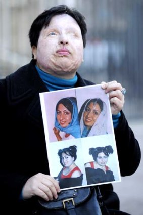Iranian Ameneh Bahrami holds photographs of herself before she was blinded by a spurned suitor who threw acid in her face.