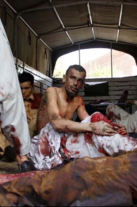 Wounded blast victims wait for help outside a hospital in Peshawar as Taliban sources vow the attacks will spread.