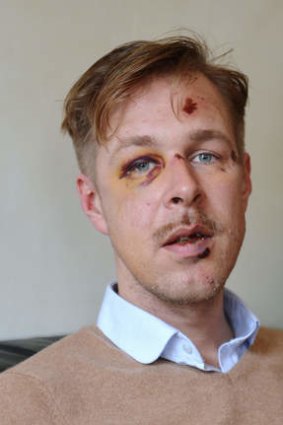 Wilfred de Bruijn: attacked while walking with his partner.