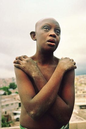 Coping with trauma … a Down syndrome sufferer in Haiti performs the butterfly technique.