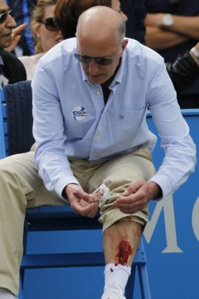 The line judge wipes blood from his injured leg.