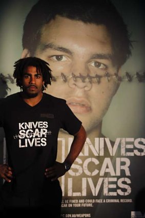 Harry O'Brien promotes the Knives Scar Lives campaign.